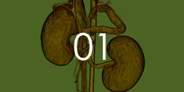 門脈体循環シャント